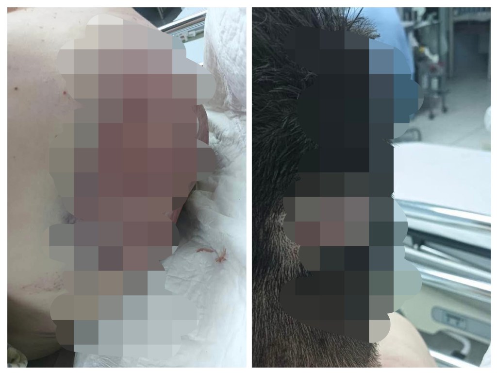 PRESUNTOS POLICÍAS AGREDEN A TRAILERO EN&nbsp;COATZACOALCOS